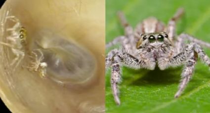 Mujer descubre que tiene una araña viva anidando en su oído y esto pasó (VIDEO)